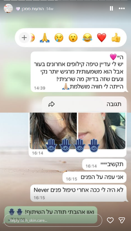 תוצאה