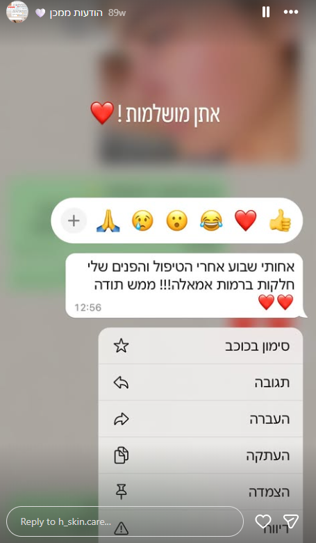 תוצאה